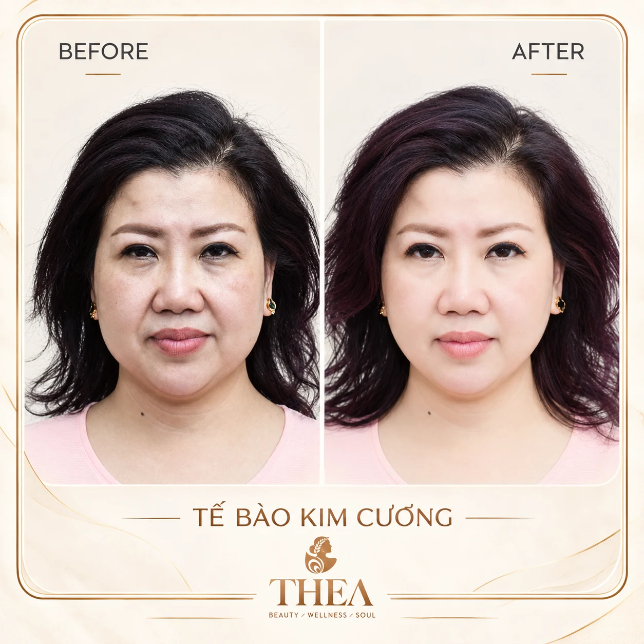 Trước và sau — Tế bào kim cương